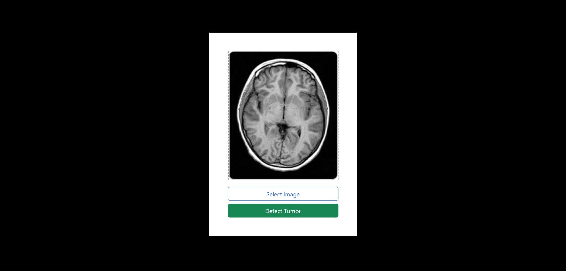 Brain X-Ray Tumor Detector user interface