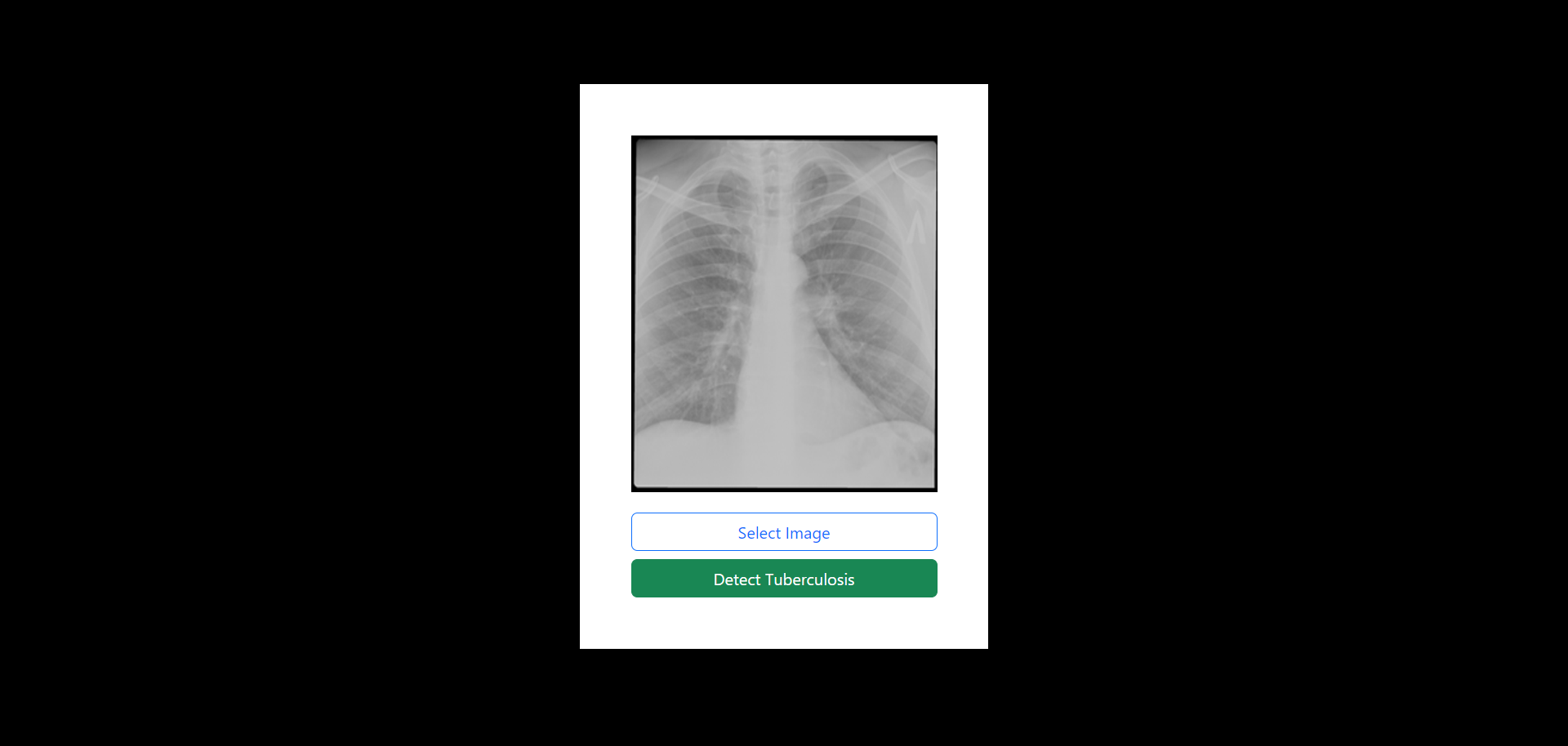Chest X-Ray Tuberculosis Detector user interface