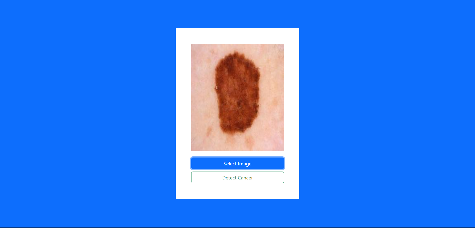 Human Skin Cancer Detector user interface